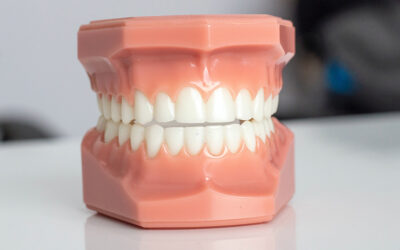 Bruxismo: el hábito inconsciente de apretar los dientes